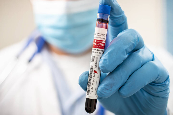 View of a doctor holding a fictional test tube blood sample, infected with Influenza virus. - Photo, image