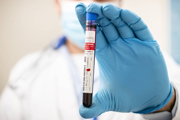 View of a doctor holding a fictional test tube blood sample, infected with tick-borne virus. - Foto, afbeelding