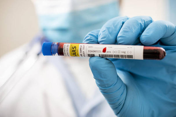 Vista de un médico sosteniendo una muestra de sangre de probeta de ficción, infectado con el coronavirus SARS
. - Foto, Imagen