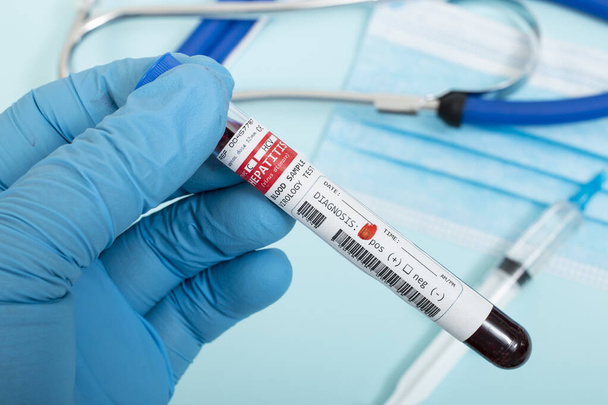 Échantillons de sang fictif infectés par le virus de l'hépatite C, avec stéthoscope, masque et seringue sur fond bleu clair
. - Photo, image