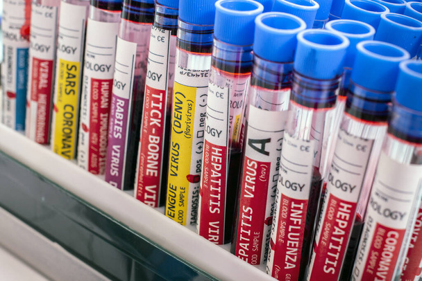 Několik fiktivních infikovaných krevních vzorků s různými viry na stojanu injekční lahvičky. - Fotografie, Obrázek