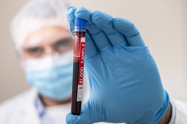 Вид врача с вымышленным образцом крови из пробирки, зараженного вирусом
. - Фото, изображение