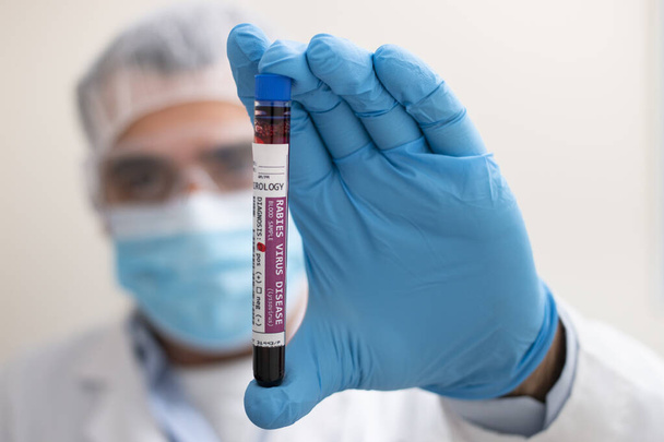 View of a doctor holding a fictional test tube blood sample, infected with rabies virus. - Valokuva, kuva