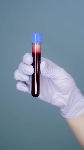 Reagenzglas mit Blut in der Hand Latex-Handschuh auf einem einheitlichen Hintergrund Riss vertikale Video - Filmmaterial, Video