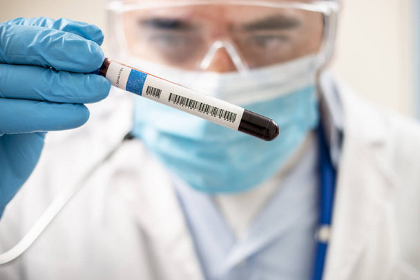 Vue d'un médecin tenant un échantillon fictif de sang prélevé dans une éprouvette, éventuellement infecté
. - Photo, image