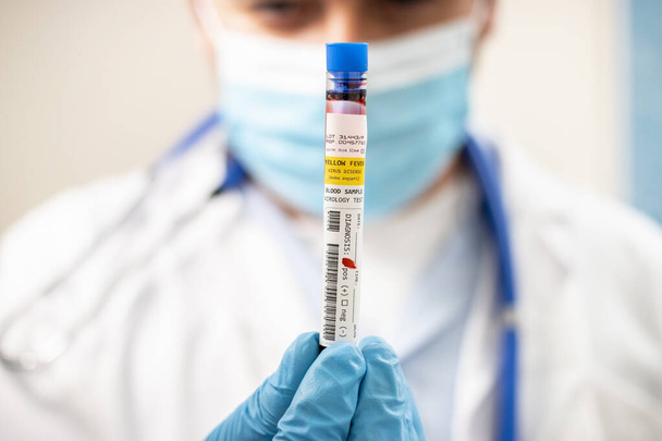 Sarı humma virüsü bulaşmış hayali bir test tüpü kan örneğini elinde tutan bir doktorun görüntüsü.. - Fotoğraf, Görsel