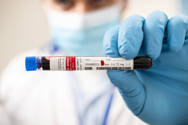 Elinde hayali bir test tüpü kan örneği tutan bir doktorun görüntüsü kene kaynaklı virüsle enfekte olmuş.. - Fotoğraf, Görsel
