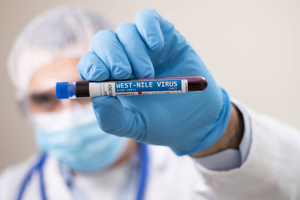 Vue d'un médecin tenant un échantillon fictif de sang prélevé dans une éprouvette, infecté par le virus du Nil occidental
. - Photo, image