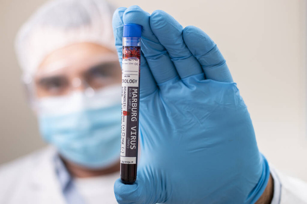 Άποψη ιατρού που διαθέτει δείγμα αίματος από δοκιμαστικό σωλήνα, μολυσμένο με τον ιό Marburg. - Φωτογραφία, εικόνα
