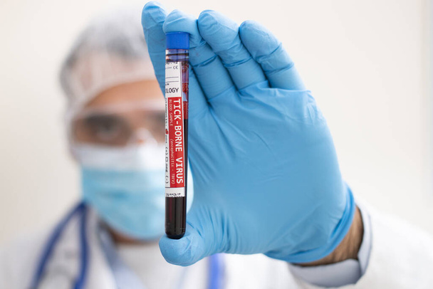 Vista de un médico sosteniendo una muestra de sangre de probeta de ficción, infectado con el virus transmitido por garrapatas
. - Foto, Imagen