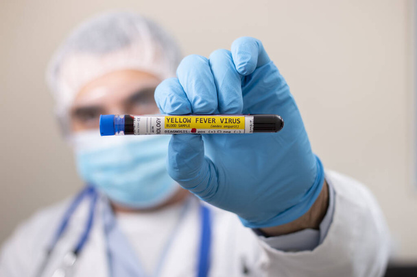 Vista de un médico sosteniendo una muestra de sangre de probeta de ficción, infectado con el virus de la fiebre amarilla
. - Foto, Imagen