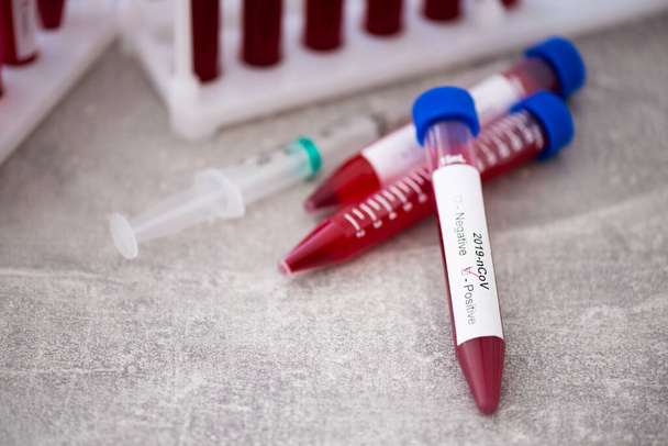 Test tube with blood sample for COVID-19 test, novel coronavirus 2019. Concept of vaccination, Covid-19 coronavirus diagnostic, cure for the flu virus. - Фото, изображение