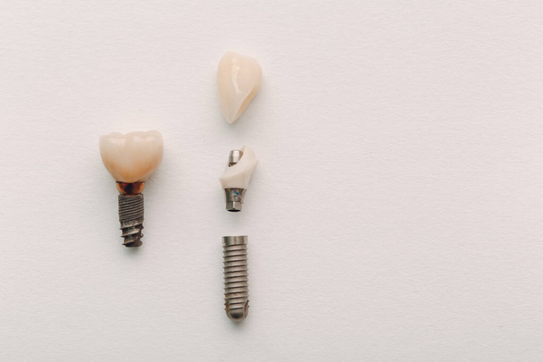 İnsan dişinin diş implantı ve beyaz arka plandaki parçaları. - Fotoğraf, Görsel