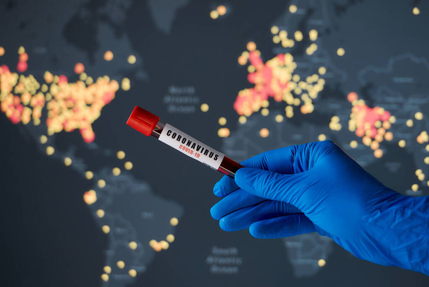 Το χέρι ενός γιατρού που κάνει μια θετική εξέταση αίματος κορωναϊού ενάντια σε έναν παγκόσμιο χάρτη. Ένας παγκόσμιος χάρτης με επιβεβαιωμένα κρούσματα COVID-19. Νόσος του Coronavirus 2019 ενημέρωση της κατάστασης παγκοσμίως εξάπλωση. - Φωτογραφία, εικόνα