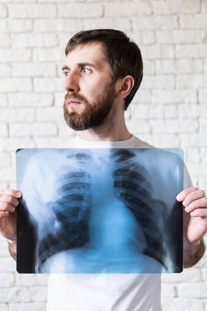 Nuori parrakas mies, jolla on röntgenfilmi keuhkoista ja sydämestä rintakehän edessä, valkoinen tausta. Pystysuuntainen
 - Valokuva, kuva