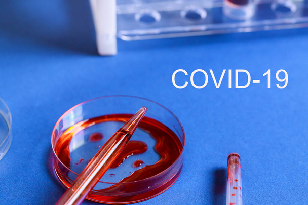 COVID-19 virus definition Middle East Respiratory Syndrome Blood sample test - Fotografie, Obrázek