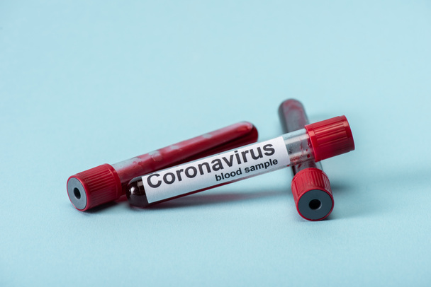 selective focus of test tubes with blood samples and coronavirus lettering on blue  - 写真・画像