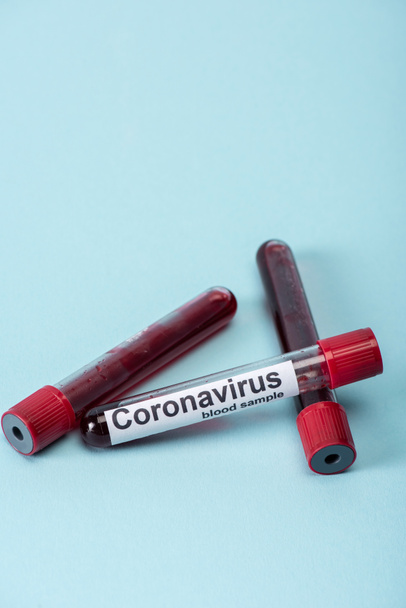 tubos de ensayo de vidrio con muestras de sangre y letras de coronavirus en azul
  - Foto, Imagen