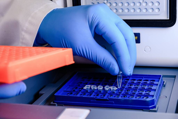 A closeup shot of a laboratory worker arranging pipette tips in a blue container for a coronavirus testing - Foto, imagen