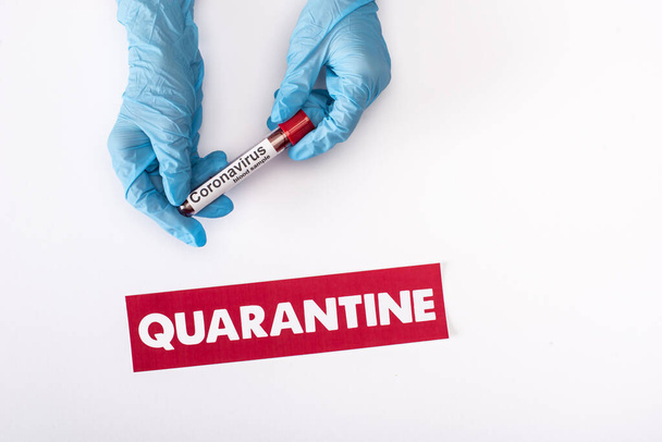 top view of doctor in latex gloves holding test tube with blood sample near quarantine lettering isolated on white  - 写真・画像
