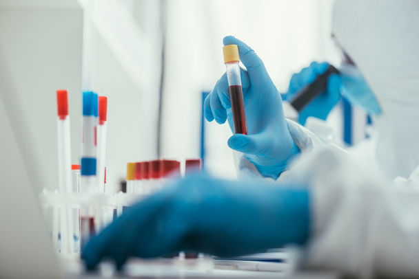 селективный фокус биохимика, держащего пробирку с образцом крови рядом с коллегой
 - Фото, изображение