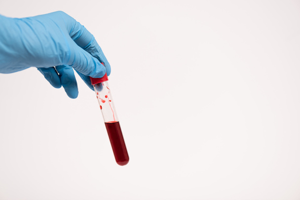 Ausgeschnittene Ansicht des Arztes in Latex-Handschuh mit Reagenzglas und Blutprobe isoliert auf weiß  - Foto, Bild