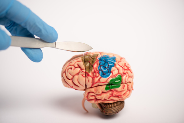 Vista recortada del cirujano sosteniendo el bisturí cerca del modelo cerebral sobre fondo blanco, concepto de enfermedad de Alzheimer
  - Foto, imagen