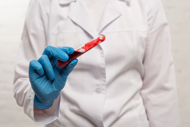 Вибірковий фокус лікаря, який тримає пробірку крові на білому тлі
 - Фото, зображення