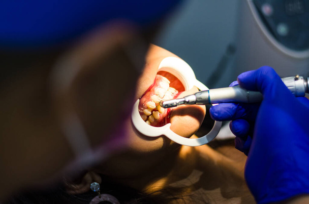 Dentist doing a dental treatment on a female patient. - Photo, Image