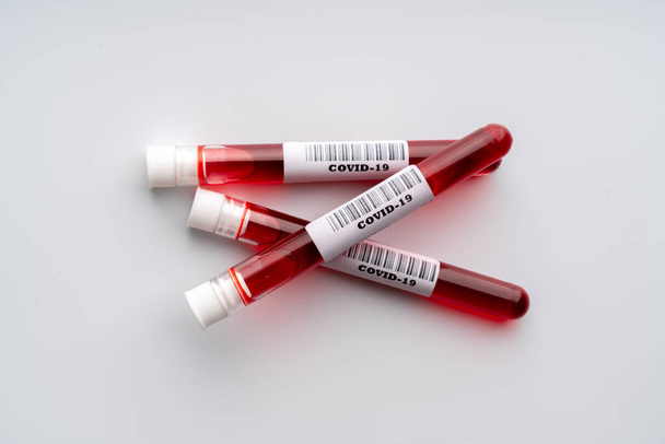 Blood test sample for COVID 19 virus  - Photo, image