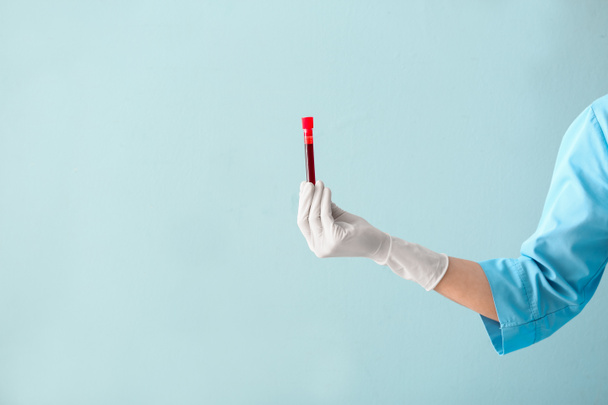 Doctor's hand holding test tube with blood sample on color background - Photo, Image