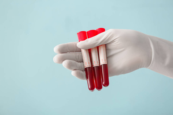 Doctor's hand holding test tubes with blood samples on color background - Photo, image