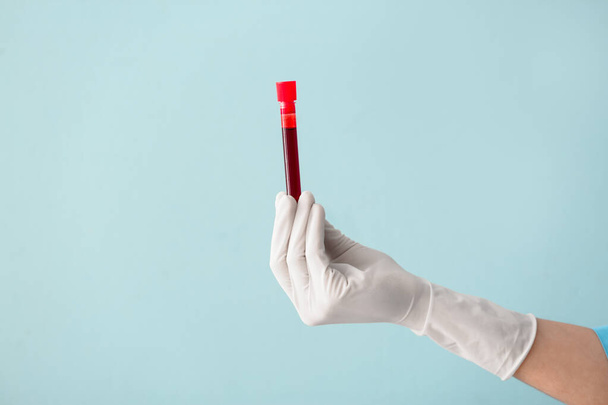 Tubo de ensayo de la mano del médico con muestra de sangre sobre fondo de color
 - Foto, imagen