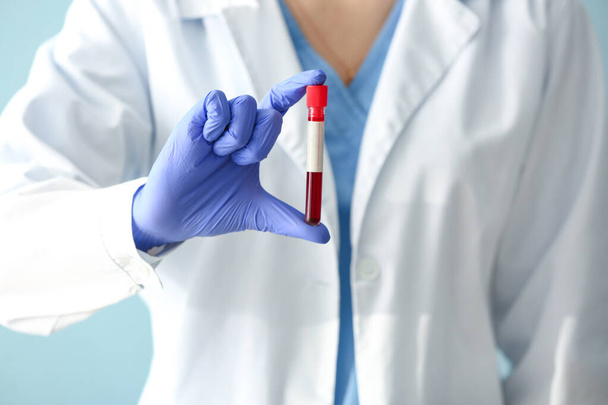 Médico sosteniendo tubo de ensayo con muestra de sangre, primer plano
 - Foto, imagen