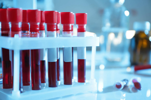 Testbuisjes met bloedmonsters op tafel in laboratorium, close-up - Foto, afbeelding