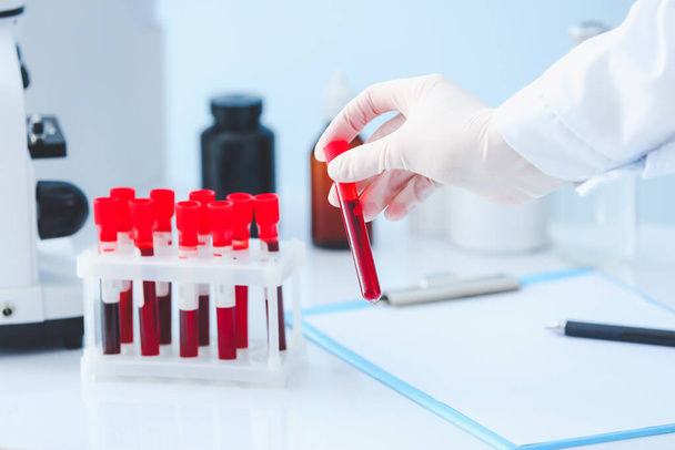 Doctor working with blood samples in laboratory - Foto, Bild