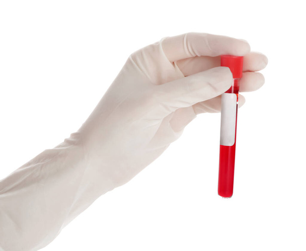 Tubo de ensayo de la mano del médico con muestra de sangre sobre fondo blanco
 - Foto, imagen