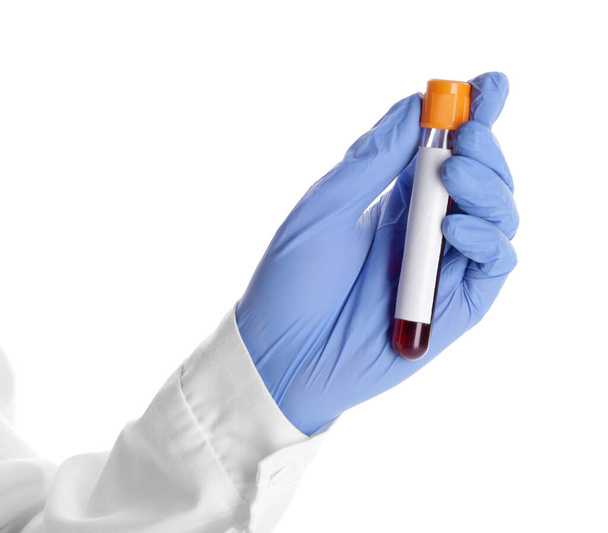Medico mano tenuta provetta con campione di sangue su sfondo bianco
 - Foto, immagini