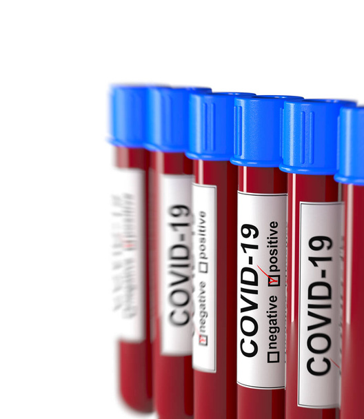 Ilustración 3D de los tubos de análisis de sangre con COVID-19 positivo y espacio de copia. Concepto para la muestra de laboratorio de análisis de sangre para el diagnóstico de la nueva infección por el virus Corona con enfoque selectivo
. - Foto, imagen
