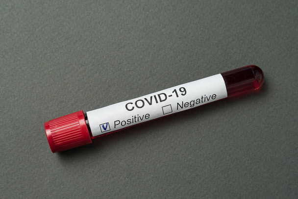 Test sanguin du coronavirus sur fond gris. Résultats positifs au test Covid-19
 - Photo, image