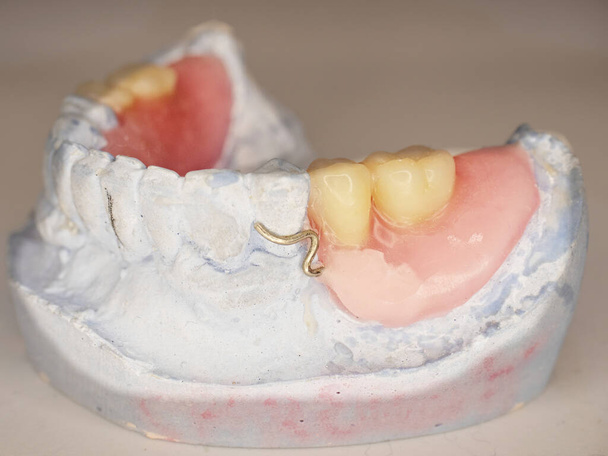 Prótese dentária artificial. Modelo de dentes humanos. Elenco de dentes com prótese parcial removível em um fundo de madeira escura
. - Foto, Imagem