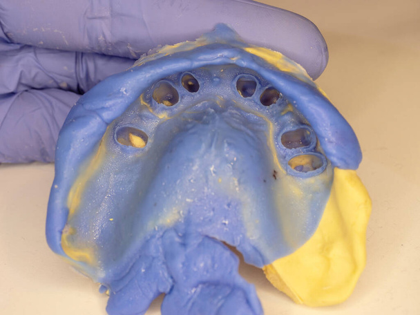 Čelisti a zuby poddajný otisk v zubní laboratoři pro výrobu sady zubů nebo falešných zubů - Fotografie, Obrázek