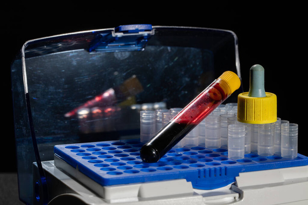 Každá lahvička s krví je transportována do laboratoře na specializované testy. - Fotografie, Obrázek