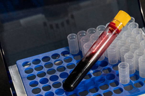 Elke injectieflacon met bloed wordt naar het laboratorium vervoerd voor gespecialiseerde tests.. - Foto, afbeelding