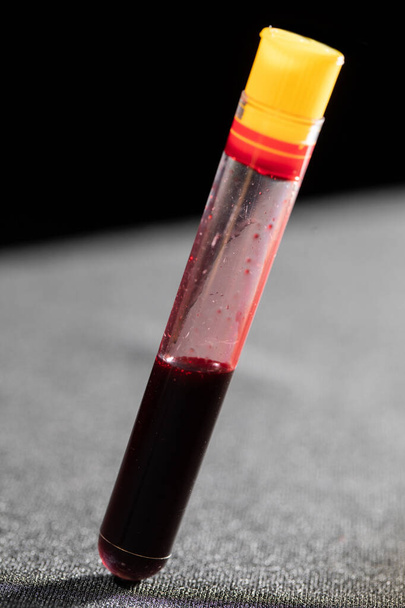 Każda fiolka krwi jest transportowana do laboratorium w celu przeprowadzenia specjalistycznych badań.. - Zdjęcie, obraz