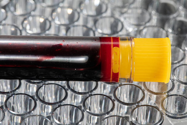 Each blood vial is transported to the laboratory for specialized tests. - Photo, image