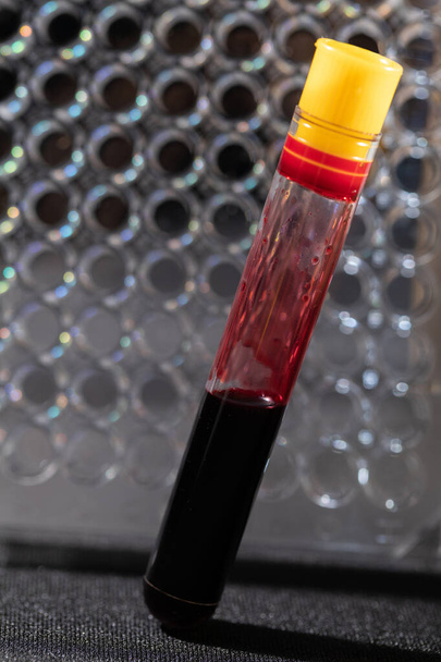Each blood vial is transported to the laboratory for specialized tests. - Zdjęcie, obraz