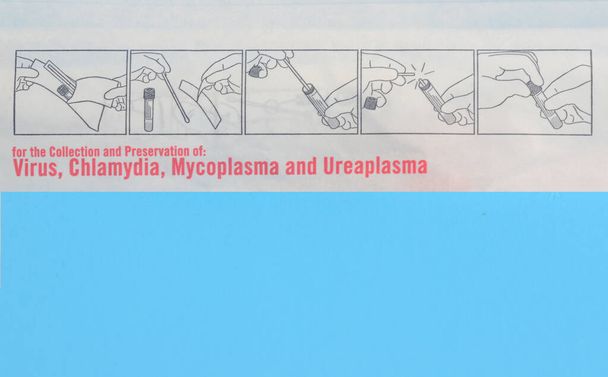 Univerzální transportní médium pro viry, chlamydie, Mycoplasma a Ureaplasma a tampon pro nasofaryngeální odběr vzorků, pro detekci respiračního viru pro kovid-19 - Fotografie, Obrázek
