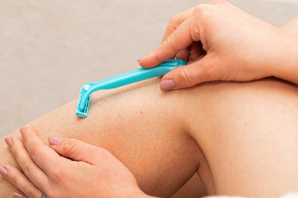 Close up picture of woman holding razor, shaving her hairy leg with folliculitis - Foto, Imagem