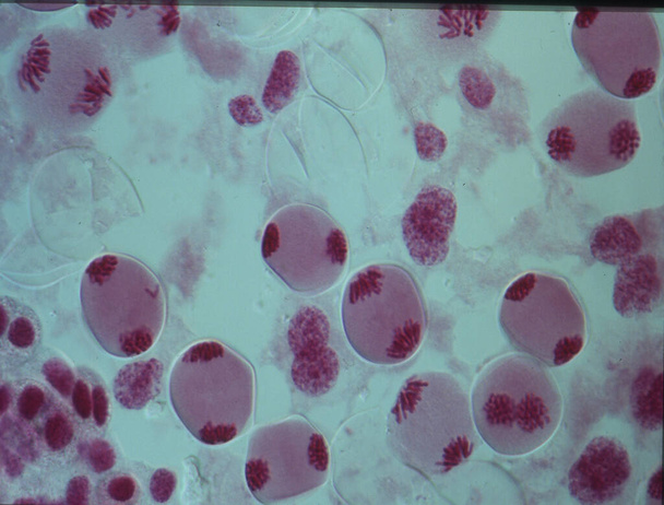Chromosomy w jądrze komórki - Zdjęcie, obraz